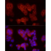 Immunofluorescence analysis of MCF7 cells using VEGFR3/FLT4 Antibody (1/100 dilution, 40x lens). Blue: DAPI for nuclear staining.