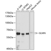Western blot analysis of extracts of various cell lines using GLMN Antibody (1/3000 dilution).