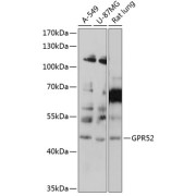 Western blot analysis of extracts of various cell lines using GPR52 Antibody (1/1000 dilution).