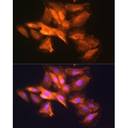 Histidine Triad Nucleotide Binding Protein 1 (HINT1) Antibody