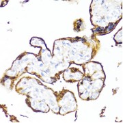 Immunohistochemistry of paraffin-embedded Human placenta using HSD17B1 Antibody (1/100 dilution, 40x lens).