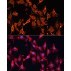 Estradiol 17-Beta-Dehydrogenase 1 (HSD17B1) Antibody