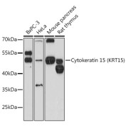 Western blot analysis of extracts of various cell lines using Cytokeratin 15 Antibody (1/3000 dilution).