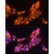 Immunofluorescence analysis of A431 cells using LAMC2 Antibody (1/100 dilution, 40x lens). Blue: DAPI for nuclear staining.