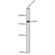 Western blot analysis of extracts of Mouse brain using LNPEP Antibody (1/500 dilution).