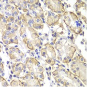 Immunohistochemistry of paraffin-embedded Human stomach using Lyn Antibody (1/100 dilution, 40x lens).