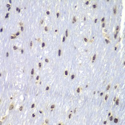 V-Yes-1 Yamaguchi Sarcoma Viral Related Oncogene Homolog (LYN) Antibody