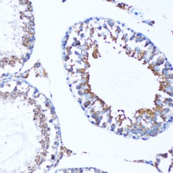 Microtubule-Associated Proteins 1A/1B Light Chain 3A (MAP1LC3A) Antibody