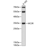 Western blot analysis of extracts of K-562 cells using MC3R Antibody (1/3000 dilution).