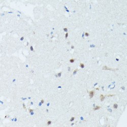 Myocyte-Specific Enhancer Factor 2C (MEF2C) Antibody