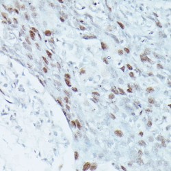 Myocyte-Specific Enhancer Factor 2C (MEF2C) Antibody