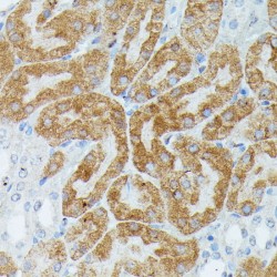 Myocyte-Specific Enhancer Factor 2C (MEF2C) Antibody