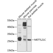 Western blot analysis of extracts of various cell lines using METTL21C Antibody (1/1000 dilution).