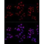 Immunofluorescence analysis of HeLa cells using Ki67 Antibody (1/100 dilution, 40x lens). Blue: DAPI for nuclear staining.