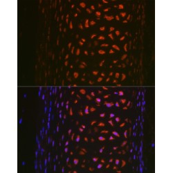 Matrix Metalloproteinase 13 (MMP13) Antibody