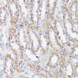 Bifunctional Methylenetetrahydrofolate Dehydrogenase/cyclohydrolase, Mitochondrial (MTHFD2) Antibody