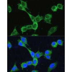 Bifunctional Methylenetetrahydrofolate Dehydrogenase/cyclohydrolase, Mitochondrial (MTHFD2) Antibody