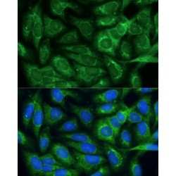 Bifunctional Methylenetetrahydrofolate Dehydrogenase/cyclohydrolase, Mitochondrial (MTHFD2) Antibody