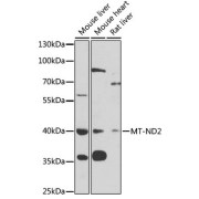 Western blot analysis of extracts of various cell lines using MT-ND2 Antibody (1/1000 dilution).