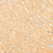 Immunohistochemistry of paraffin-embedded Rat heart using MYBPC3 Antibody (1/100 dilution, 40x lens).