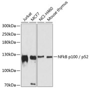 Western blot analysis of extracts of various cell lines using NFkB p100 / p52 Antibody (1/1000 dilution).