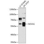 Western blot analysis of extracts of various cell lines using NOVA1 Antibody (1/3000 dilution).