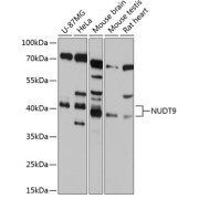 Western blot analysis of extracts of various cell lines using NUDT9 Antibody (1/1000 dilution).