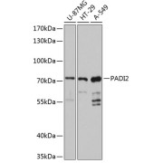 Western blot analysis of extracts of various cell lines using PADI2 Antibody (1/3000 dilution).