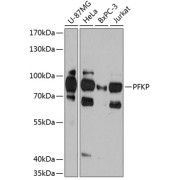 Western blot analysis of extracts of various cell lines using PFKP Antibody (1/3000 dilution).