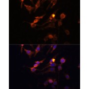 Immunofluorescence analysis of C6 cells using PINK1 Antibody (1/100 dilution, 40x lens). Blue: DAPI for nuclear staining.