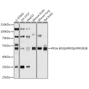 Western blot analysis of extracts of various cell lines using PP2A-B55β/PR55β/PP2A-B55β/PR55β/PPP2R2B Antibody (1/1000 dilution).