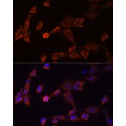 Immunofluorescence analysis of NIH-3T3 cells using PSMD14 Antibody (1/100 dilution, 40x lens). Blue: DAPI for nuclear staining.