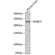 Western blot analysis of extracts of Mouse brain using ROBO3 Antibody (1/1000 dilution).