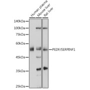 Western blot analysis of extracts of various cell lines using PEDF/PEDF/SERPINF1 Antibody (1/1000 dilution).