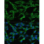 Immunofluorescence analysis of NIH/3T3 cells using SMAD3 Antibody (1/100 dilution). Blue: DAPI for nuclear staining.