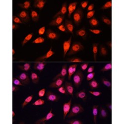 Transcription Factor SOX-2 (SOX2) Antibody