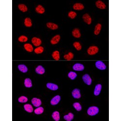 Transcription Factor SOX-2 (SOX2) Antibody