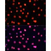 Immunofluorescence analysis of C6 cells using SOX2 Antibody (1/100 dilution, 40x lens). Blue: DAPI for nuclear staining.