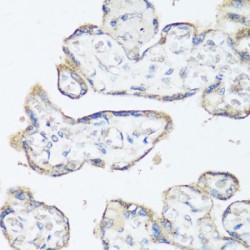 SRC Proto-Oncogene, Non-Receptor Tyrosine Kinase (SRC) Antibody