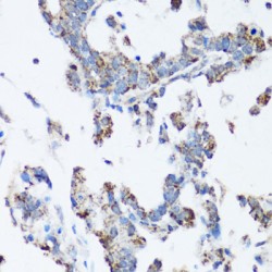 SRC Proto-Oncogene, Non-Receptor Tyrosine Kinase (SRC) Antibody