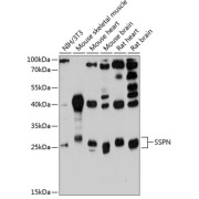 Western blot analysis of extracts of various cell lines using SSPN Antibody (1/3000 dilution).