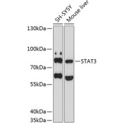 Western blot analysis of extracts of various cell lines using STAT3 Antibody (1/1000 dilution).