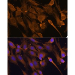 STIP1 Homology And U-Box Containing Protein 1 (STUB1) Antibody