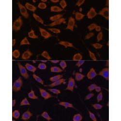 STIP1 Homology And U-Box Containing Protein 1 (STUB1) Antibody