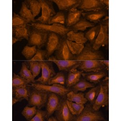 STIP1 Homology And U-Box Containing Protein 1 (STUB1) Antibody