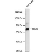 Western blot analysis of extracts of Rat testis using TEKT5 Antibody (1/3000 dilution).