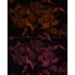 Toll-Like Receptor 3 (TLR3) Antibody