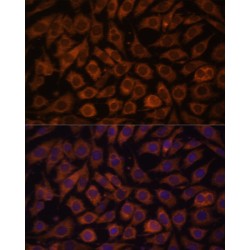 Toll-Like Receptor 3 (TLR3) Antibody