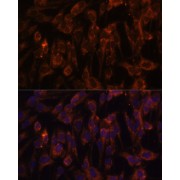 Immunofluorescence analysis of C6 cells using TLR3 Antibody (1/100 dilution). Blue: DAPI for nuclear staining.