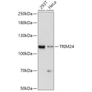 Western blot analysis of extracts of various cell lines using TRIM24 Antibody (1/1000 dilution).